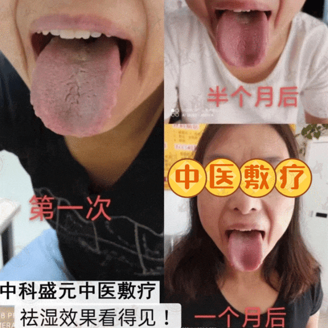 雨水节气后,补脾土,祛湿气,唤醒脾胃生机!_效果_身体_三焦