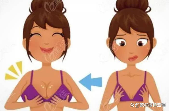 到底哪个好自体脂肪隆胸和假体隆胸哪个好,自体脂肪丰胸缺点是啥_细胞