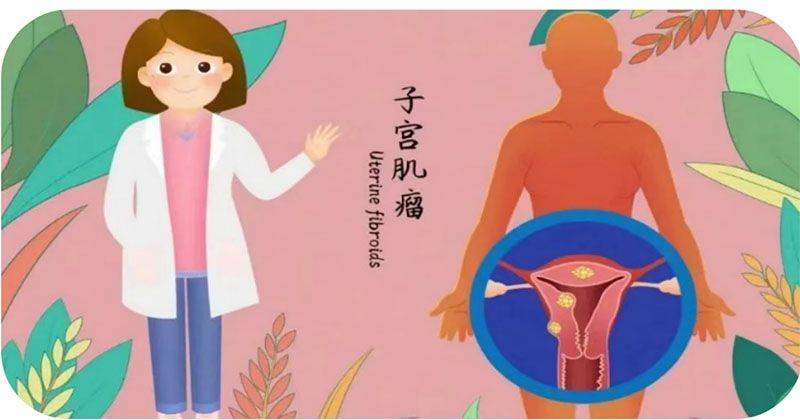 泰安市妇幼保健院:带您认识子宫肌瘤,不必谈"瘤"色变_检查_症状_压迫