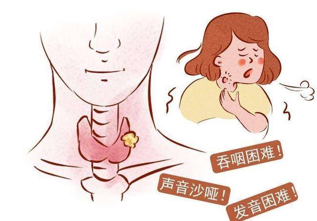 声带息肉,不做手术不行吗?_症状_问题_发声