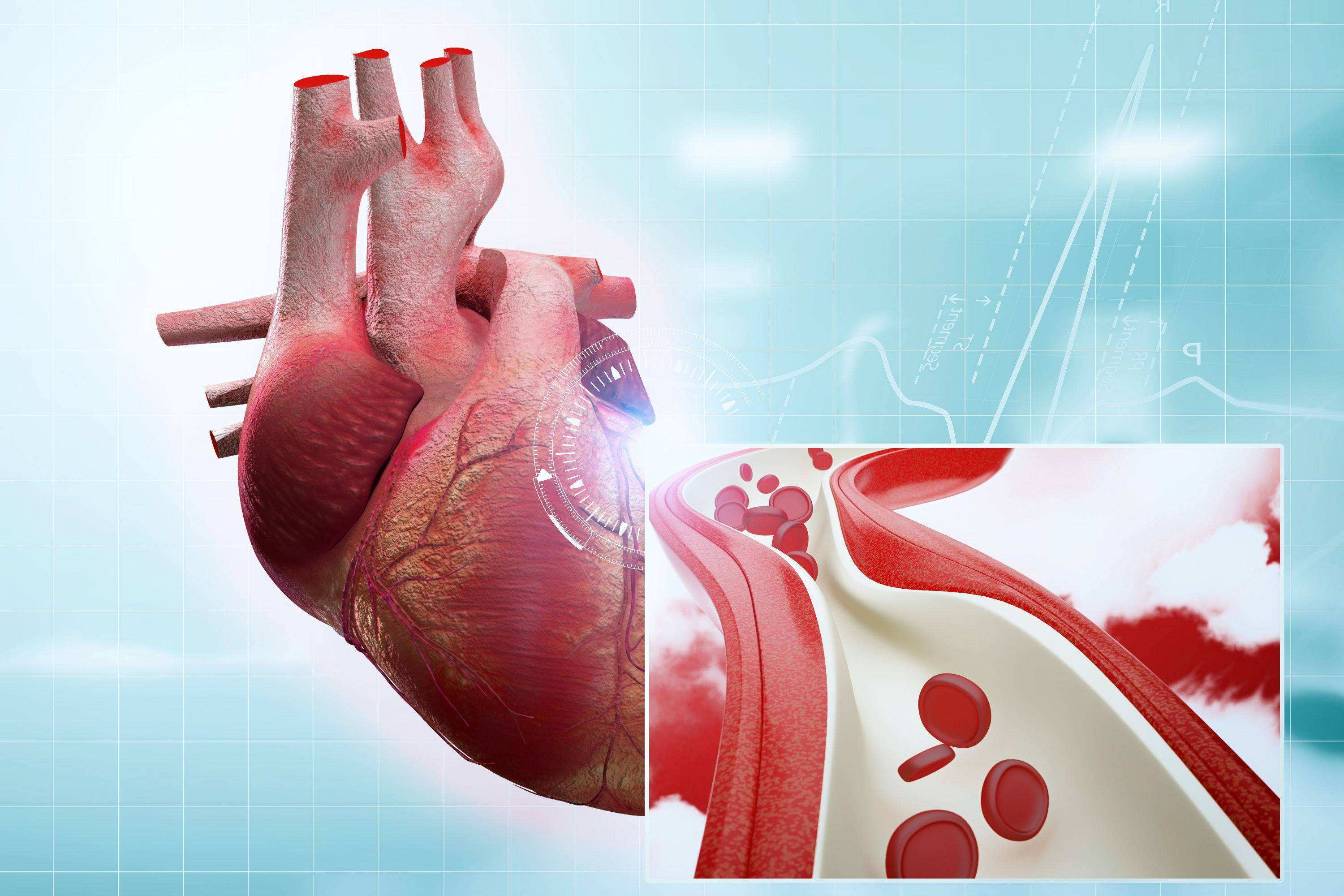 悦思立普:高甘油三酯血症首选药物是什么?_治疗_患者_降低