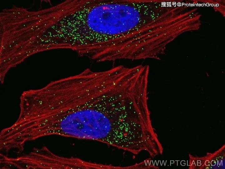 marker_蛋白_高尔基体