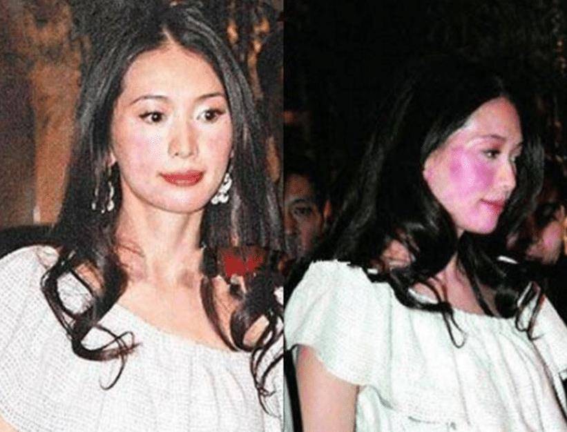 2007年,林志玲被逼喝酒过敏全身通红,那英怒斥:你在这装什么