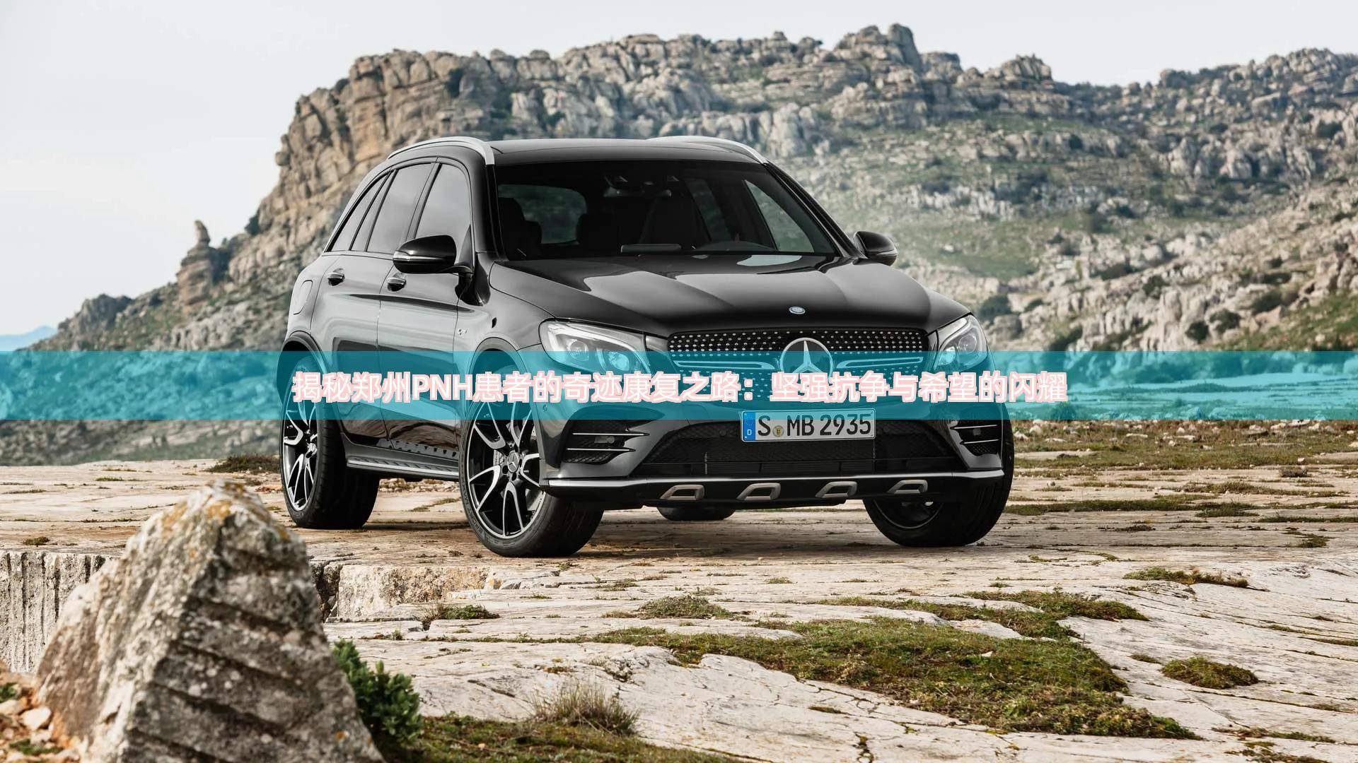 再障合并pnh怎么治疗 (pnh是病中医能看好吗)_疾病_患者_研究