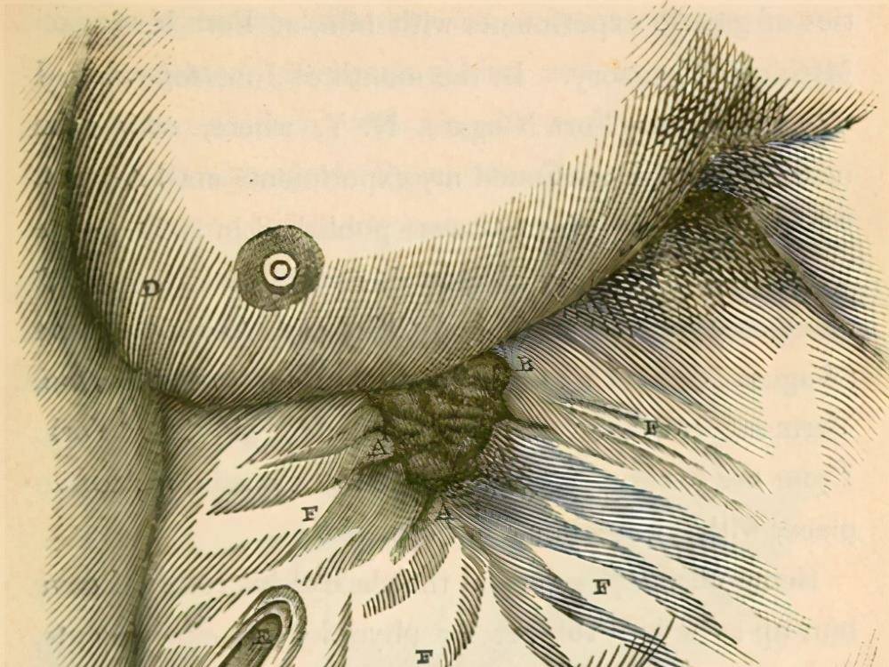 子弹贯穿身体,却奇迹存活下来,最终他成了学者研究人体的试验品