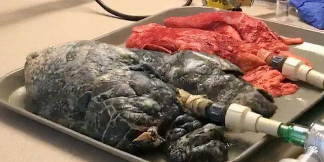 舌头上,然后是咽部,气管,焦油长期附着在这些人体的部位,严重的就会