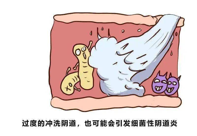 华克维两性霉素b阴道泡腾片有奇效!_甜食_霉菌性_性生活