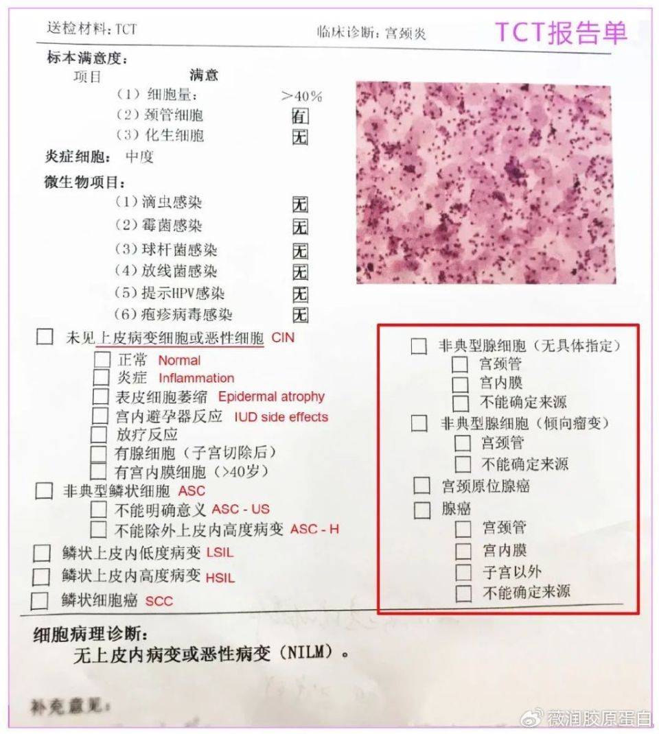 tct检查正常单子图片图片