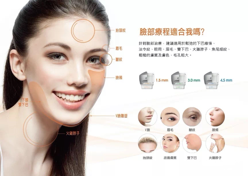 超声刀:痛感很强,会敷表麻操作,最早国外会打全麻操作;热玛吉:五代