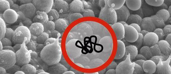 炭疽孢子由一个坚硬的外壳和被包裹的dna 少量蛋白质组成,为了生存