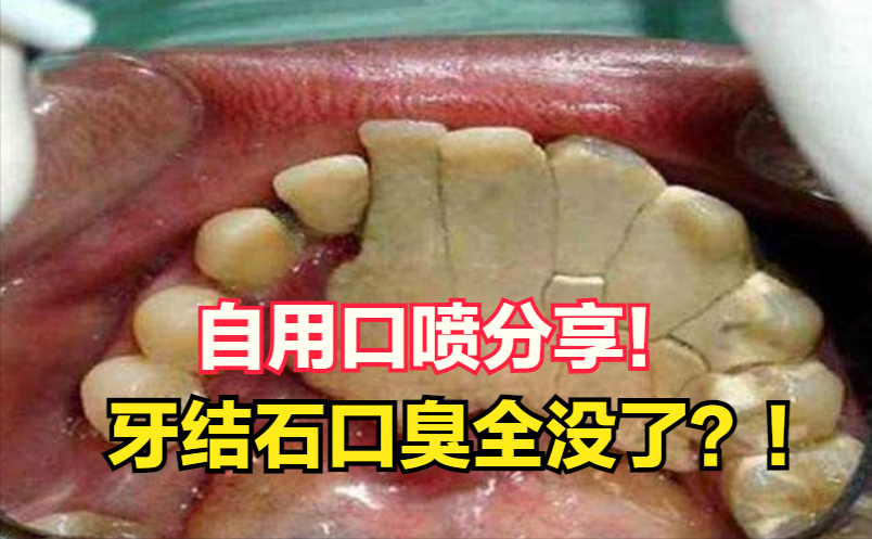 果然还是国货靠谱!彻底解决口臭尴尬!_那味道_薄荷味_清香