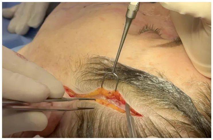 一位外科医生的筋膜旅程_组织_系统_结构