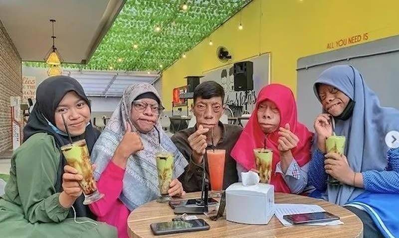 印尼4兄妹患罕见怪病,长着一张"动物"的脸,酷似三星堆面具_苏里亚