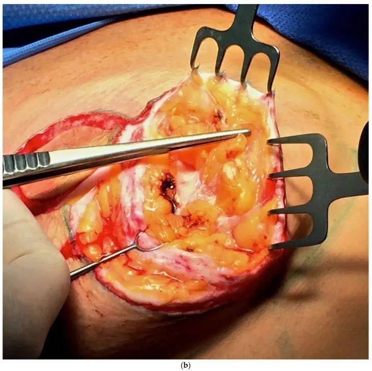 一位外科医生的筋膜旅程_组织_系统_结构