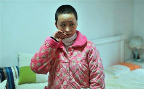 合肥16岁花季少女,因婉拒官二代追求被泼汽油毁容,获赔180万元_周岩