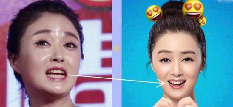 李沁牙齿变白了?《微微一笑很倾城》孟逸然整牙如换脸,颜值飙升