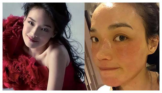 舒淇晒惊人粗壮手臂照,搞笑自曝奇怪病情,网友热议!_问题_生活_照片