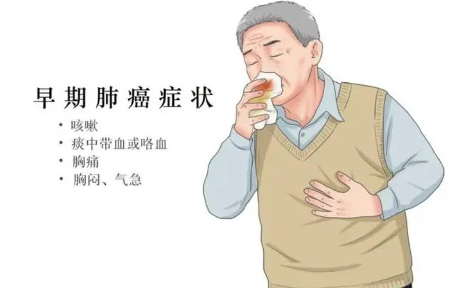 咯血是肺癌吗