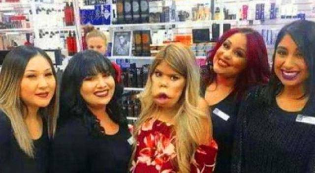 原创印度猴头女孩因相貌特殊被富豪倒追娶回家如今过得怎样