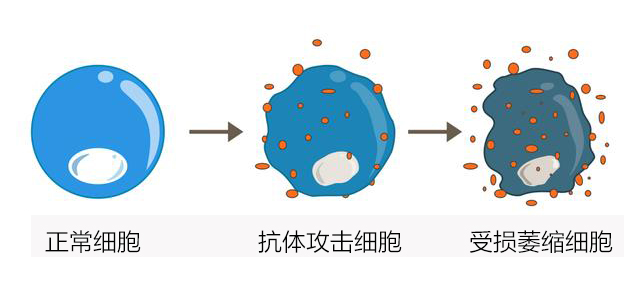 说明免疫损伤在不断加重,甲状腺受损情况也在不断加重.
