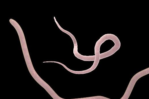 原创宝宝出现这五种症状说明宝宝肚子里有蛔虫你家宝宝中枪了吗