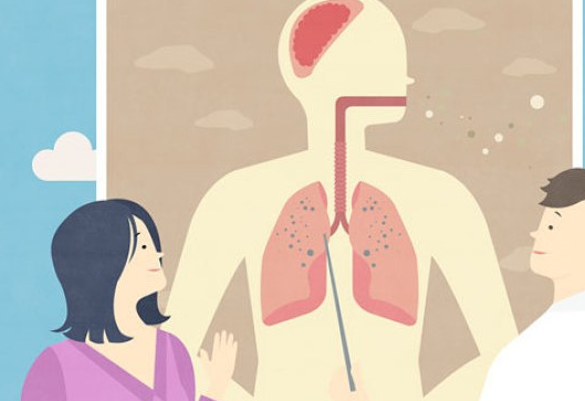 咳嗽不停,分清类型并找准原因,才能有效止咳_黏液_因为_症状