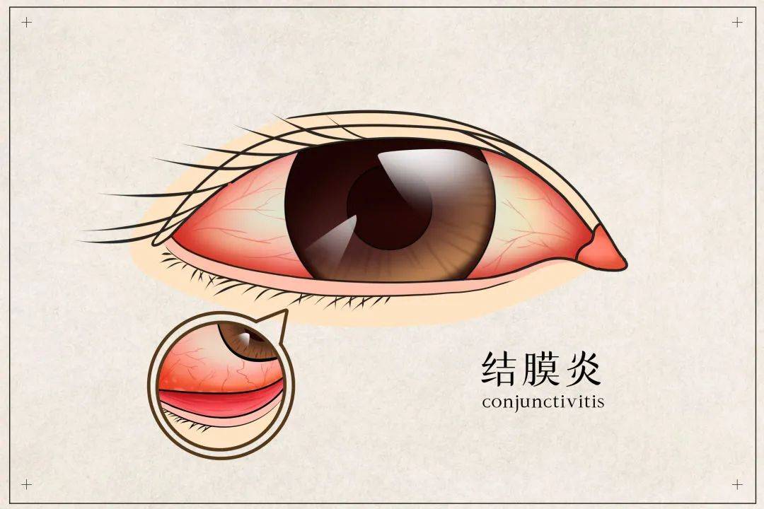 眼睛角膜结膜位置图图片