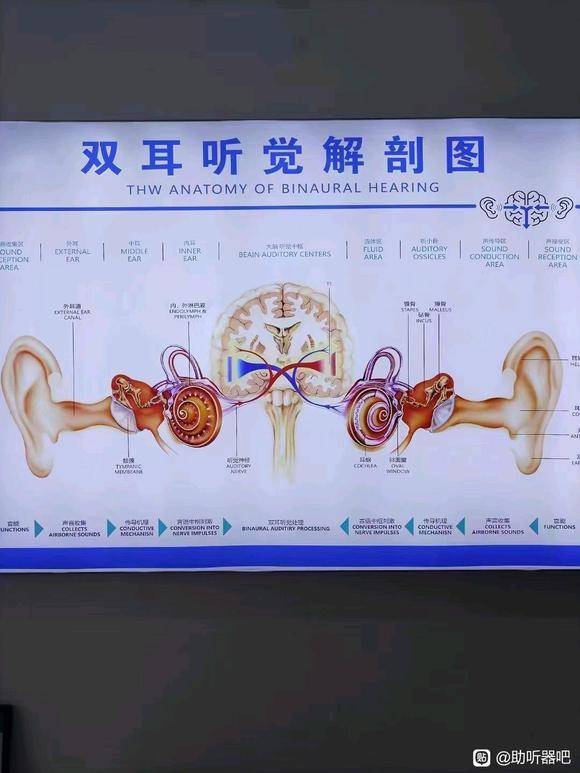 助听器内部结构图图片