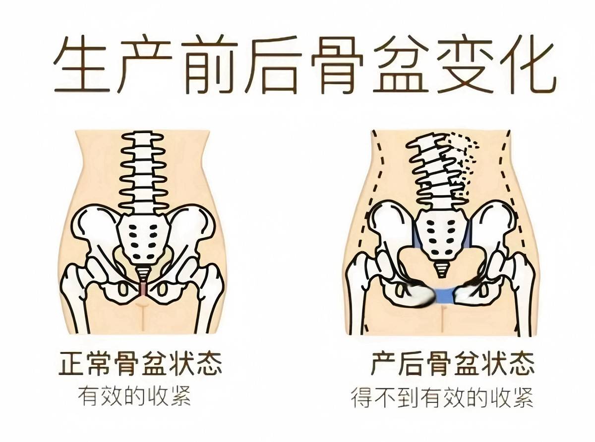 送髋和不送髋的图对比图片