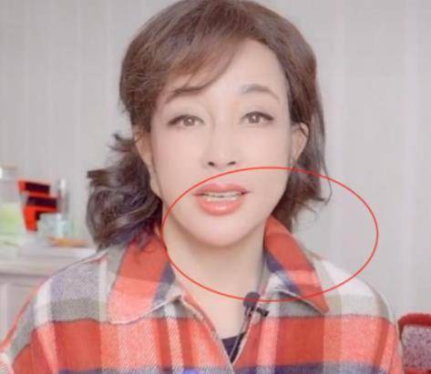 原创70岁刘晓庆面具脸太雷人耳垂下巴都连在一起能不能真实点