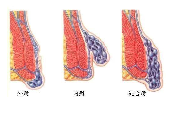 肛门正常是什么样的图片