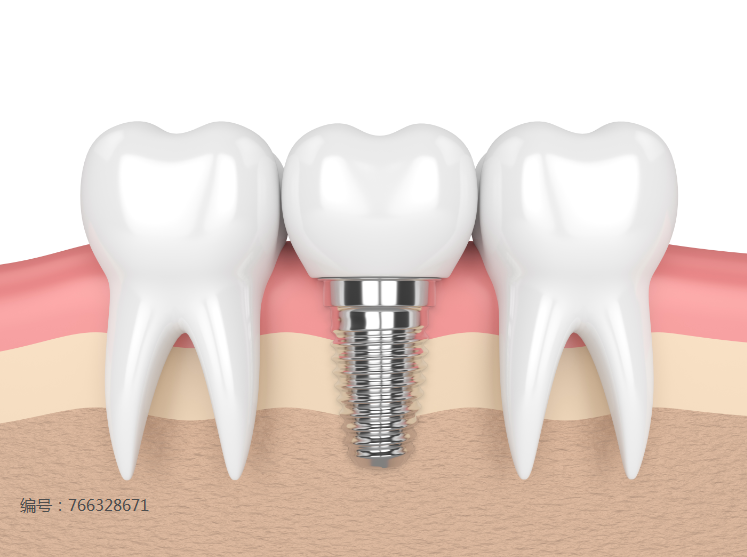 牙冠_父母_牙齿