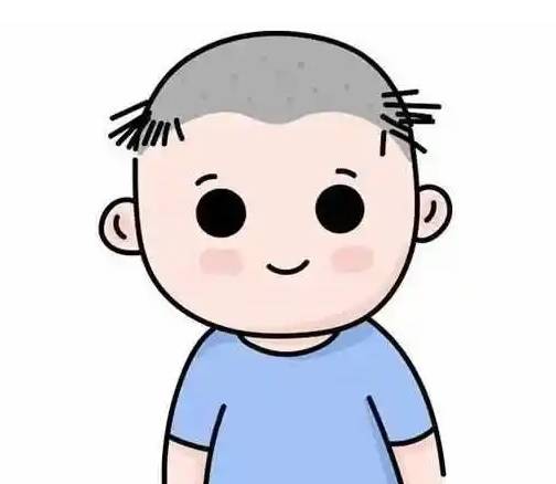 头皮_头发_问题