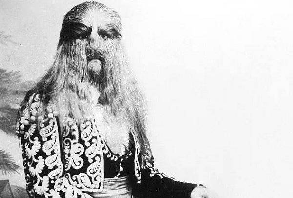 真正的半狮人因怪异外形红遍欧洲精通5国语言却不幸早逝