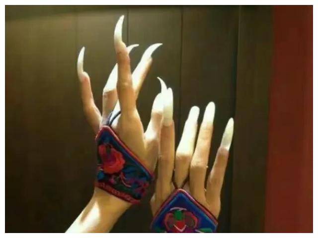 杨丽萍62岁爱甲不慎折断,保险百万赔偿引热议,众人热议中!