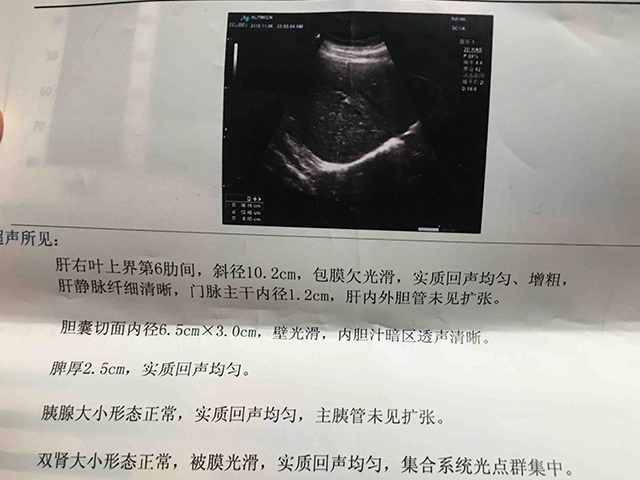 原创乙肝父亲被查出早期肝硬化女儿我在就不让你放弃治疗