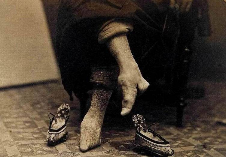 女性要缠三寸金莲,脚越小求亲的越多_小脚_人们_女子