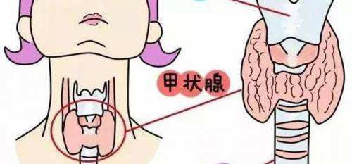 28岁女白领查出最懒的癌因工作忙最后拖成癌转移