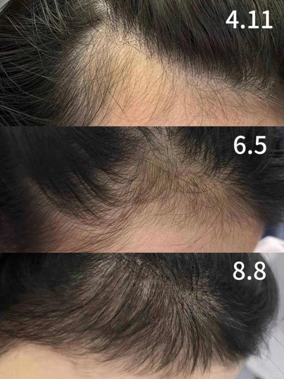 哪种洗发水防脱发的效果特别好这几款安心拯救掉发人士
