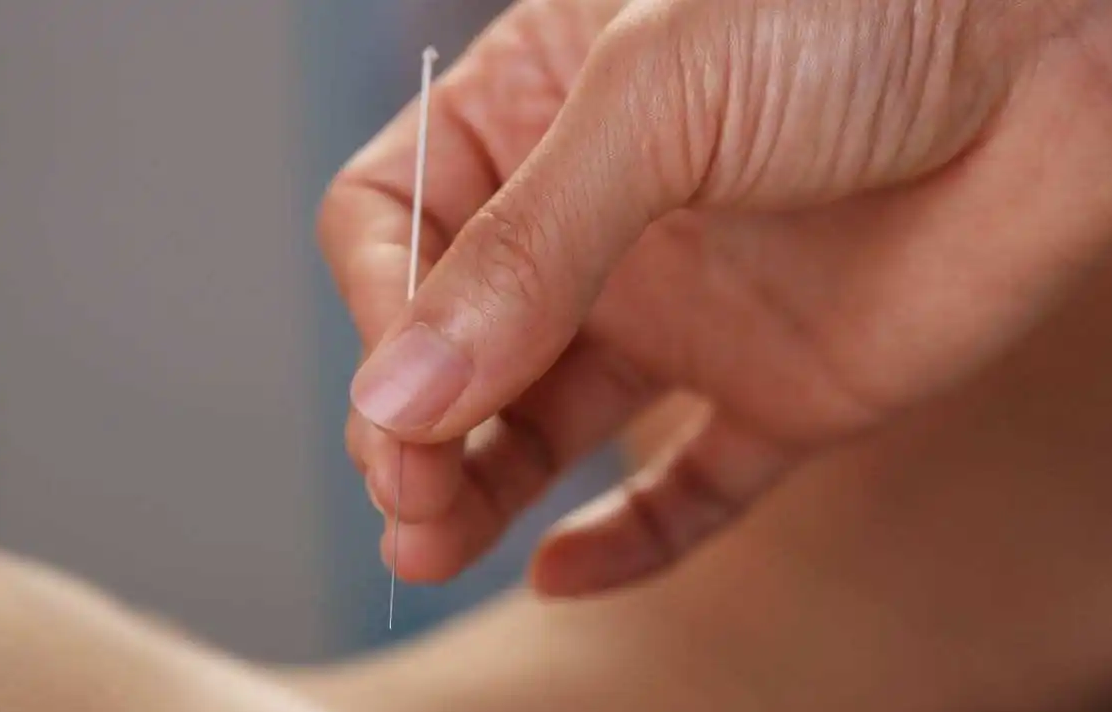 针灸推拿古法调理身体_治疗_气血_经络