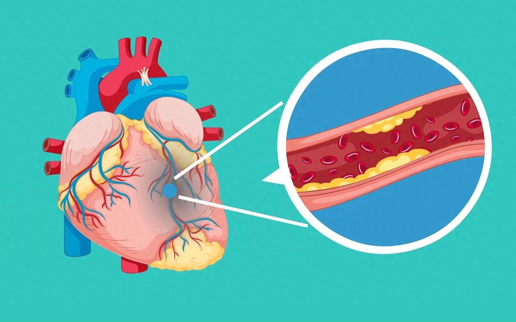 守护心血管健康,这些检查必不可少!检查前这些错误不要犯!