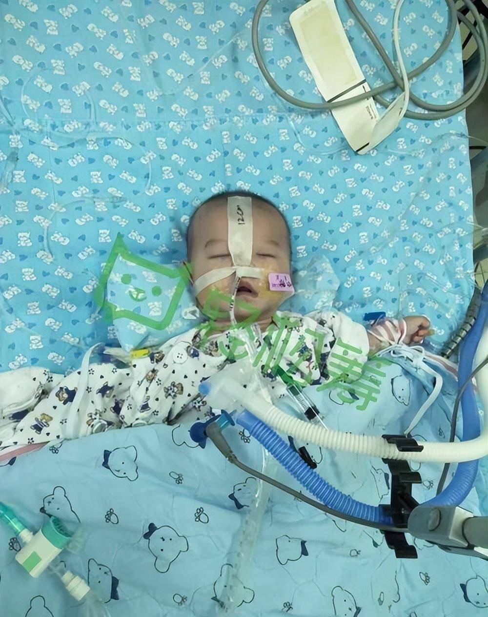 数百名婴儿在洛马琳达大学儿童健康中心成功进行了心脏移植手术