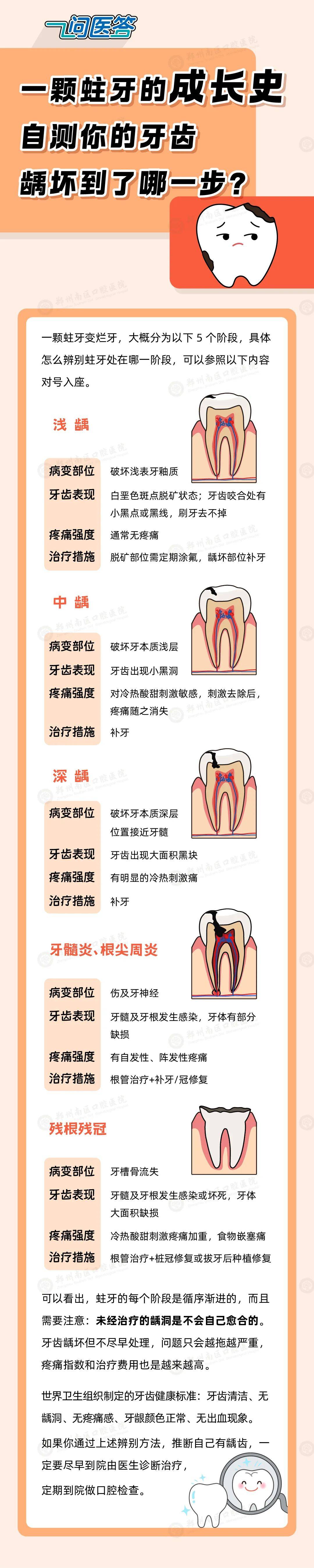 龋齿的形成过程图片图片