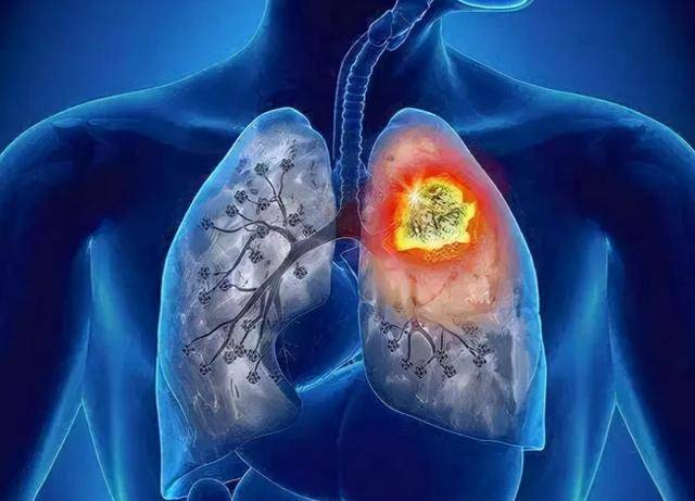 原创凌晨34点自然醒再难入睡中医提醒多半是这2处堵了