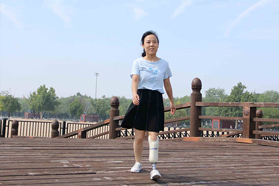 半足假肢多少钱足截肢患者如何装配半足假肢