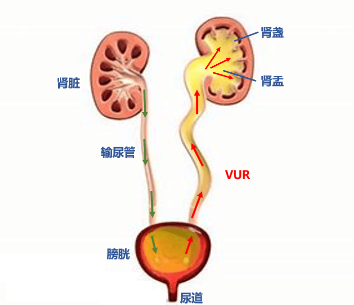 肾与膀胱连接图图片