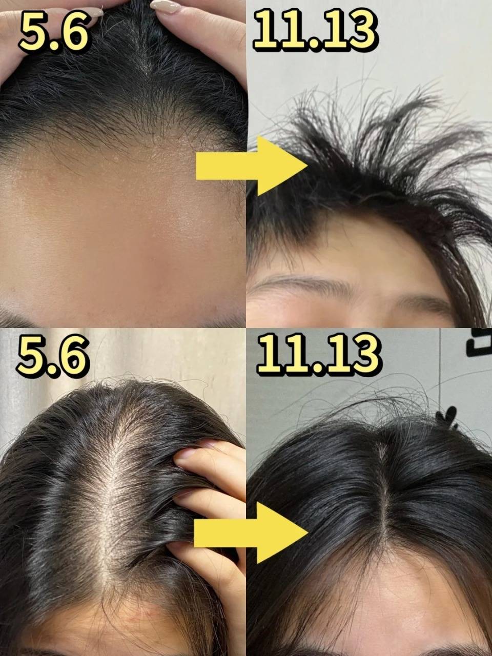 生发防脱发洗发水什么牌子好发量救急来用它