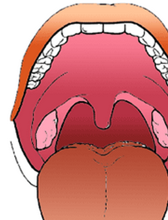 可出现在口腔的任何部位,包括唇,舌,口底,颊黏膜,齿龈,上颚臼骨齿后区