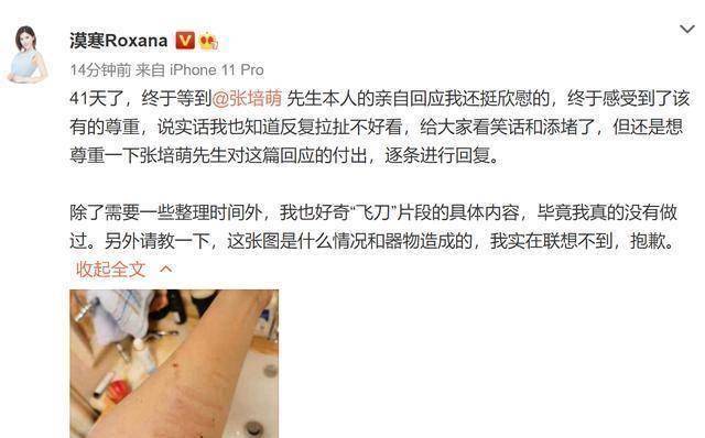 张莫涵写道:41天了,终于等到张培萌先生本人的亲自回应我还挺欣慰的