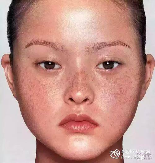斑点_面部_脏腑